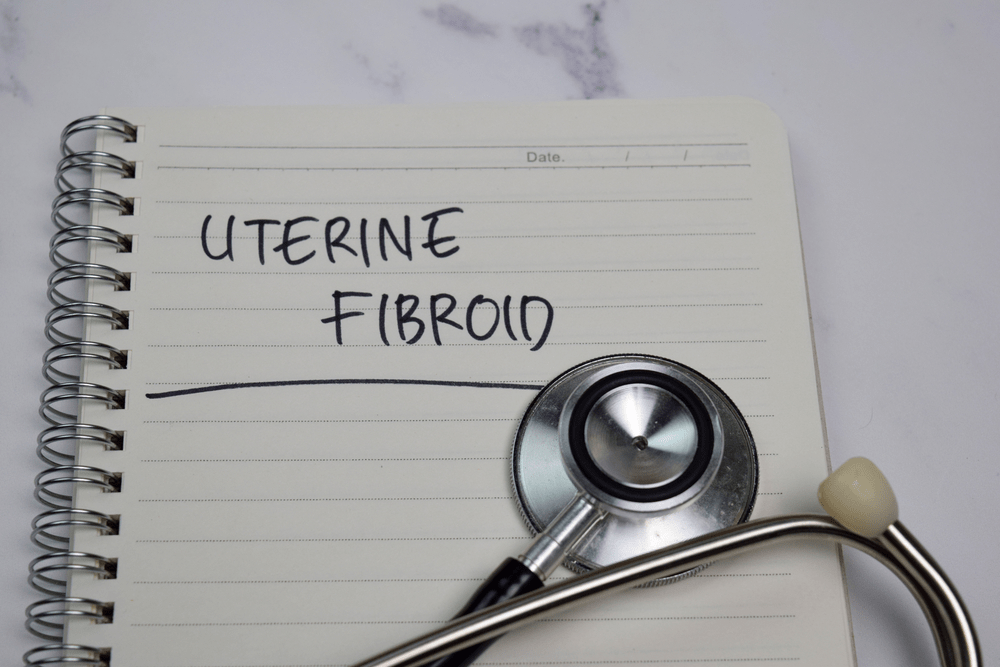 How Is Uterine Fibroid Embolization Performed?