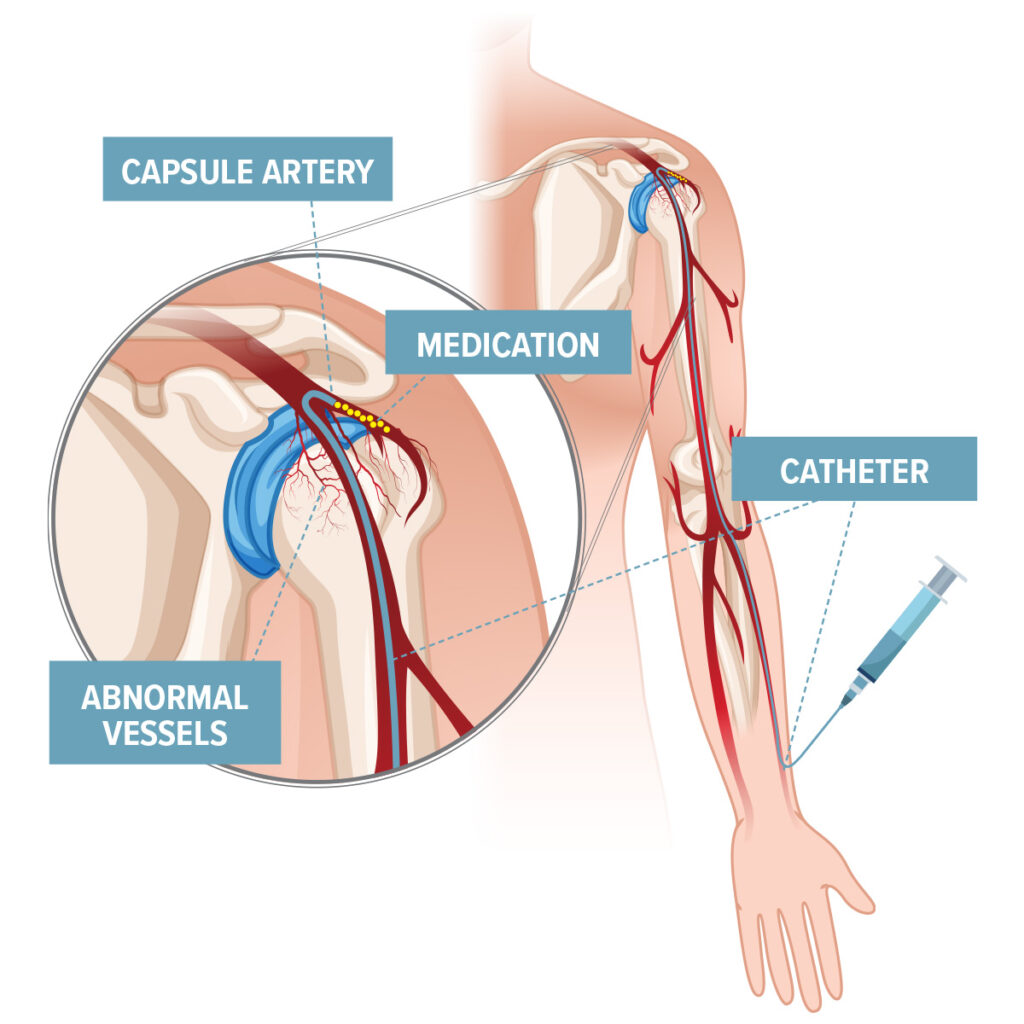 how aes works diagram